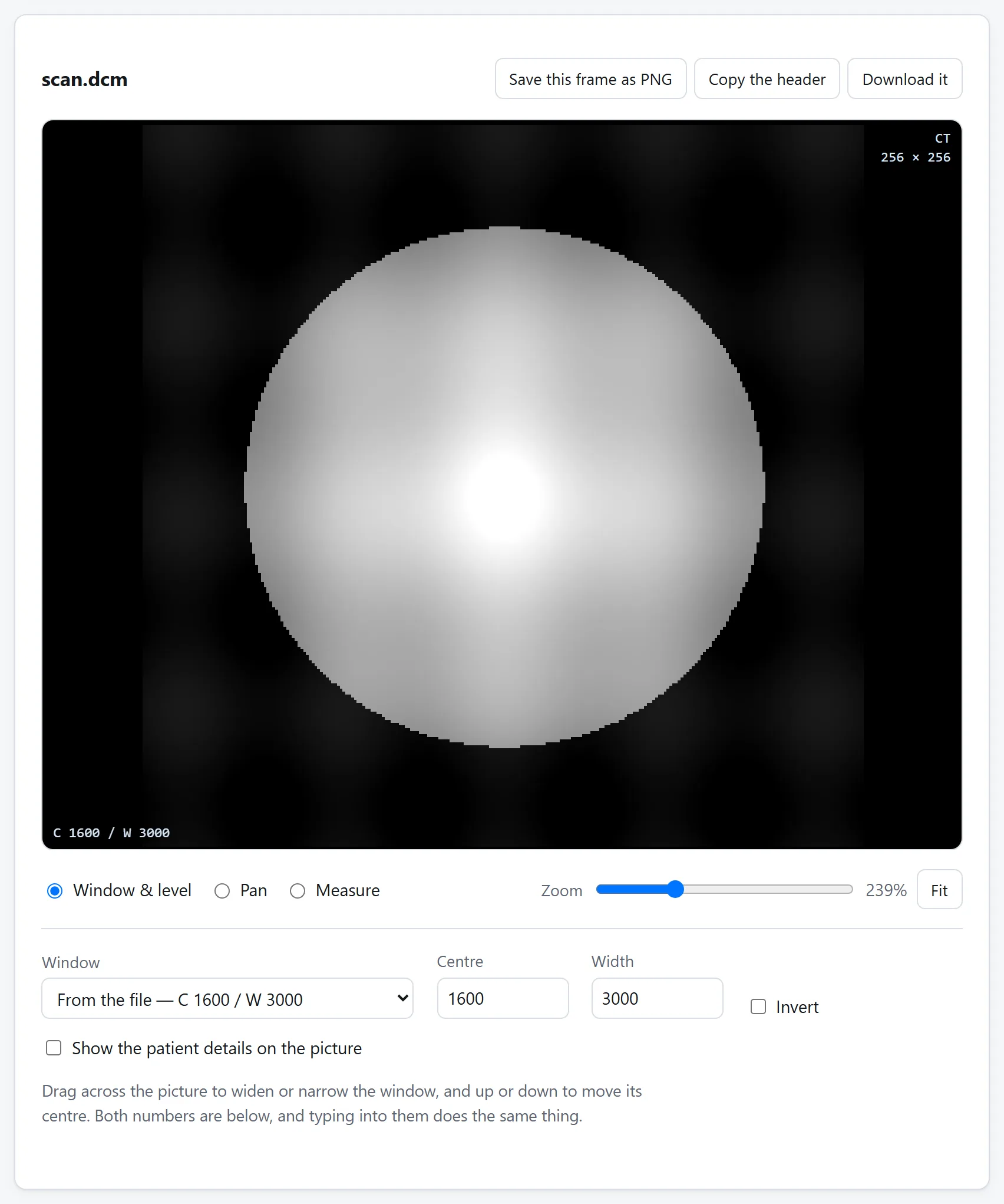 The viewer: a greyscale scan slice with the window and level controls beside it, presets for common tissue ranges, and the study details in the corners.
